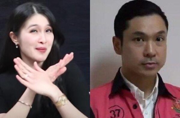 Suami Jadi Tersangka, Sandra Dewi Sakit dan Jalani Operasi Ambeien Stadium Empat